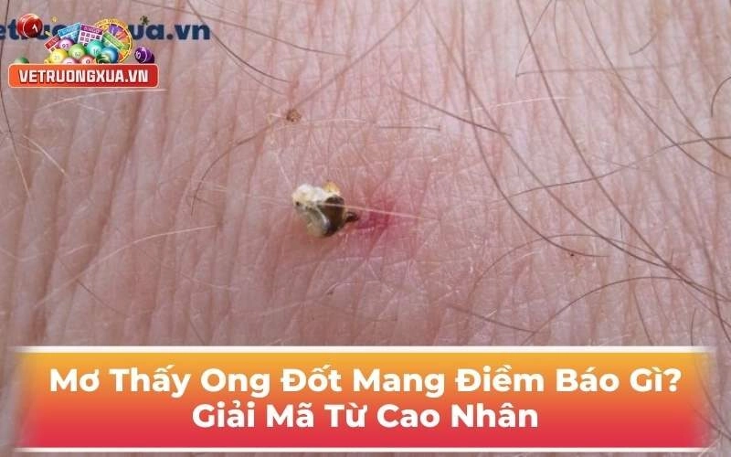 Mơ Thấy Ong Đốt Điềm Báo Gì? Giải Mã Từ Cao Nhân